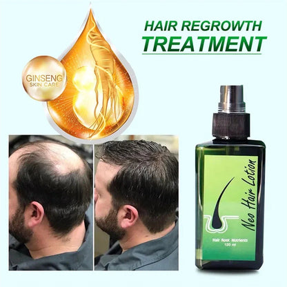 بخاخ علاج تساقط الشعر  120ML